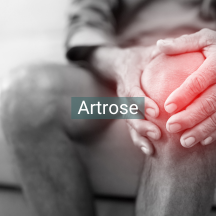 Artrose